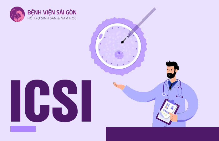 Quy trình thực hiện ICSI