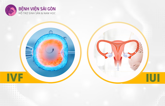 Sử dụng phương pháp IUI hoặc IVF phù hợp với tình trạng nam giới gặp vấn đề về tinh trùng