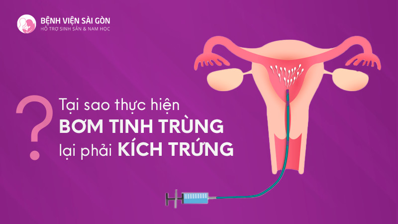 Tại sao khi thực hiện IUI cần phải kích trứng