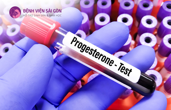 Xét nghiệm Progesterone xác định khả năng sinh sản của phụ nữ