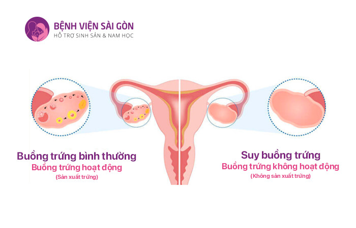 Nếu lượng LH trong cơ thể quá nhiều có thể gây ra tình trạng suy buồng trứng ở nữ giới