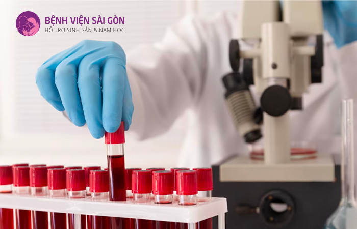 Xét nghiệm tiểu cầu trong công thức máu giúp chẩn đoán tình trạng nhiễm độc thai nghén