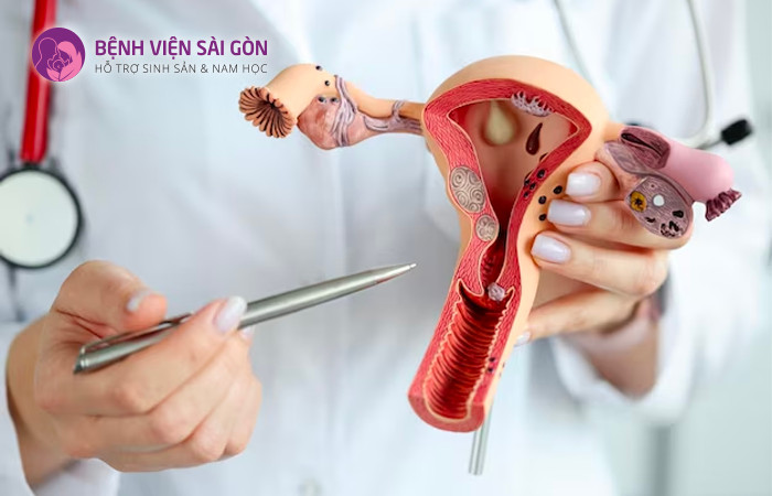 Hình ảnh giải phẫu học của tử cung ở cơ quan sinh dục nữ