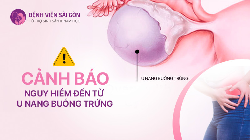 Cảnh báo nguy hiểm đến từ u nang buồng trứng