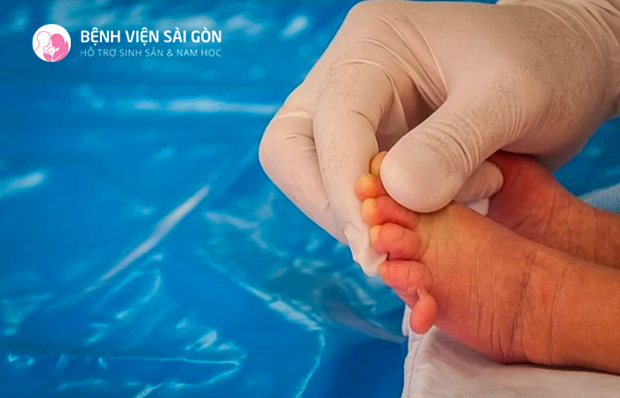 Biểu hiện của hội chứng Patau thường là thừa ngòn tay, ngón chân ở trẻ