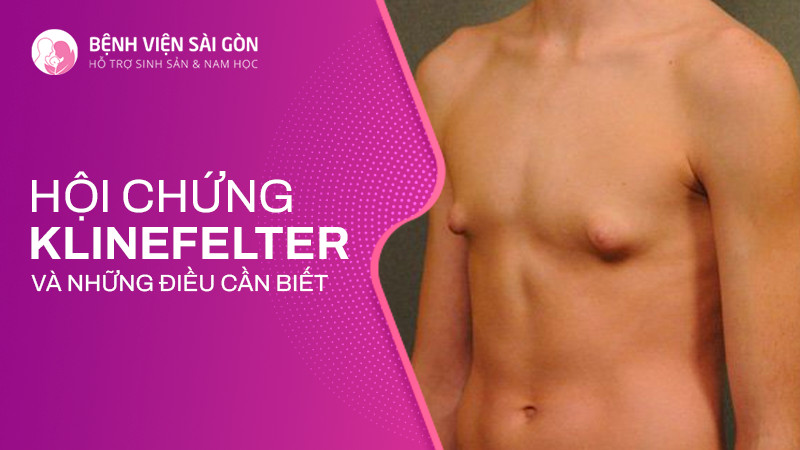 Hội chứng Klinefelter và những điều cần biết