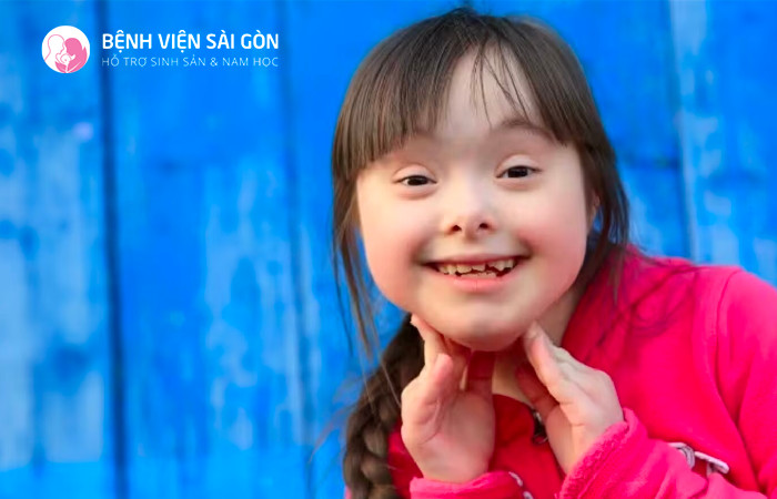 Trẻ mắc hội chứng Down có sống mũi phẳng và mắt xếch lên trên