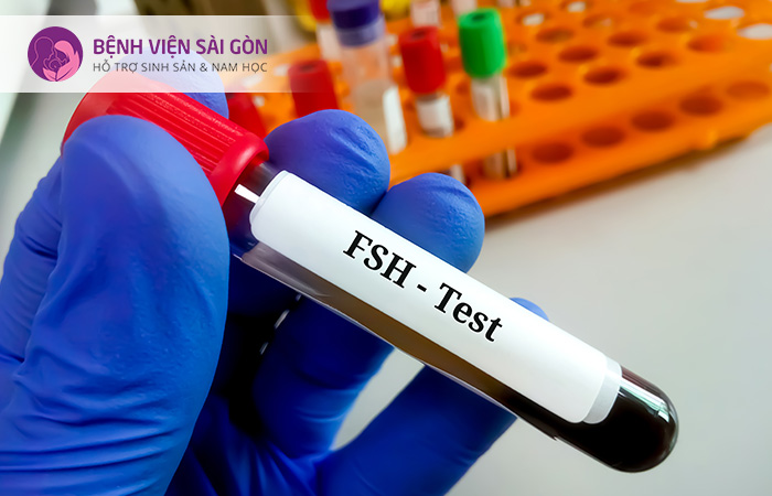 FSH test giúp xác định nồng độ nội tiết tố hỗ trợ cho việc chẩn đoán tình trạng sức khỏe