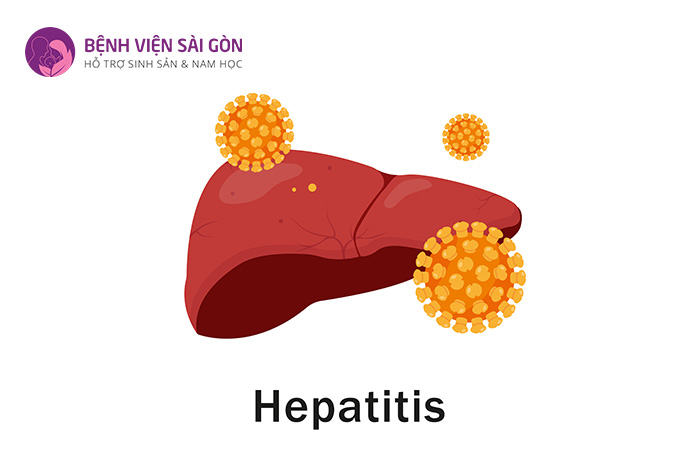 Viêm gan B là một bệnh nhiễm trùng gan nghiêm trọng do virus HBV gây ra