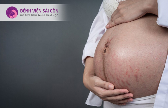 Khi mang thai cơ thể người mẹ xuất hiện các vết trên da khiến họ tự ti và làm mẹ bầu khóc nhiều