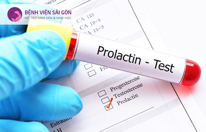 Xét nghiệm nồng độ Prolactin giúp đánh giá tình trạng sức khỏe sinh sản ở nam và nữ giới