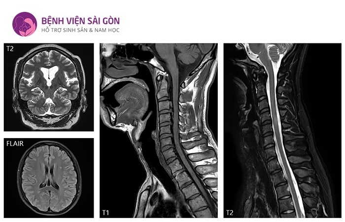 Hình ảnh MRI rõ nét, giúp các bác sĩ chẩn đoán chính xác hơn