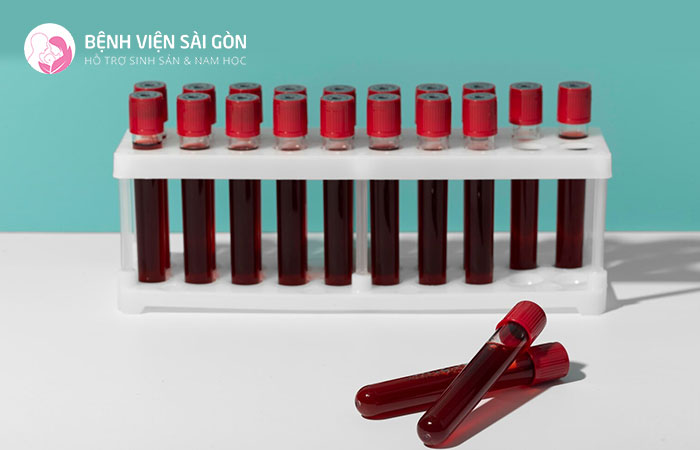 Xét nghiệm chức năng đông máu được tiến hành giống như các xét nghiệm máu thông thường