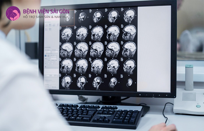 Chụp cắt lớp vi tính CT giúp phát hiện khối u hoặc huyết khối ở não