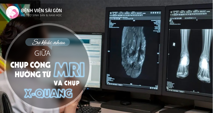 Chụp cộng hưởng từ MRI và chụp X-quang có gì khác nhau