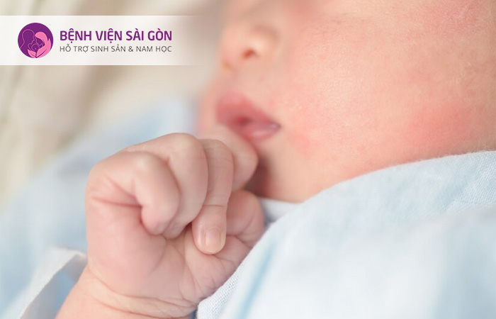 Nhiễm trùng ở trẻ sơ sinh là tinh trạng vi khuẩn xâm nhập và gây bệnh ở trẻ