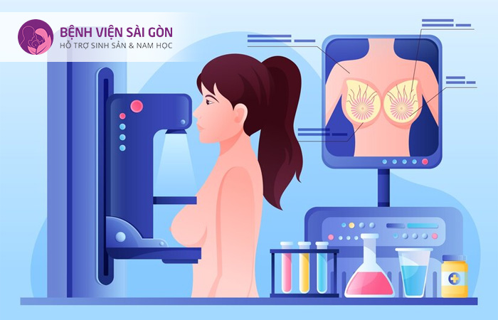 X-quang ngực có thể thấy được mật độ xơ nang tuyến vú