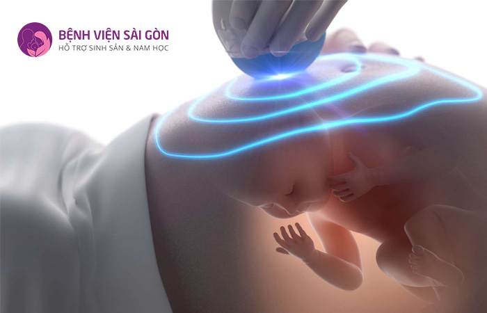 Hình ảnh siêu âm giúp các bác sĩ chẩn đoán được tình trạng của thai nhi