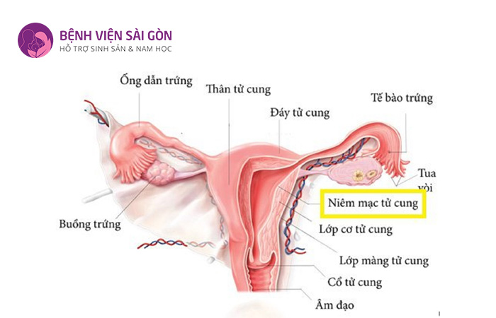 Niêm mạc tử cung hay nội mạc tử cung nằm trong hệ thống cơ quan sinh dục nữ