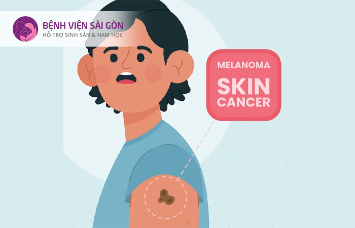 Ung thư da không hắc tố gồm ung thư biểu mô tế bào vảy và biểu mô tế bào đáy
