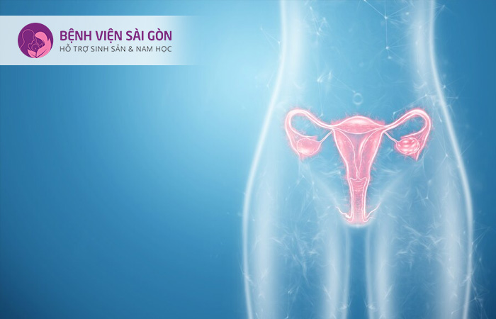 Hở eo tử cung là nguyên nhân dẫn đến các trường hợp sinh non