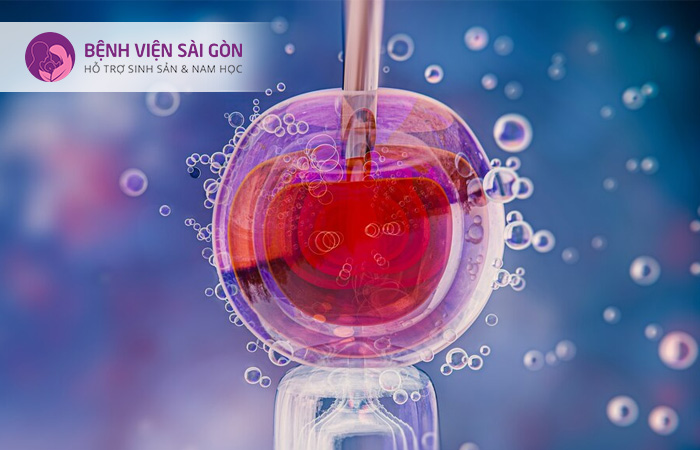 IVF mini là phương pháp thích hợp cho người mắc Hội chứng PCOS