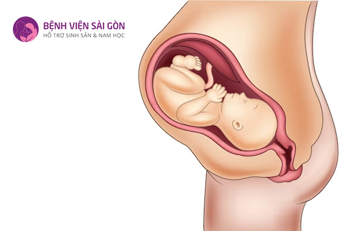 Người mẹ mang đa thai rất dễ gặp phải tình trạng sa dây rốn