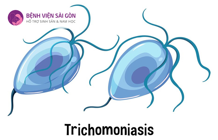 Chlamydia trachomatis là một trong những nguyên nhân gây ra tình trạng nhiễm trùng niệu đạo