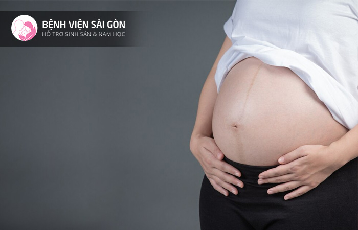 2 tháng cuối thai kỳ vùng chậu bị đè nặng khiến mẹ bầu mắc bệnh trĩ