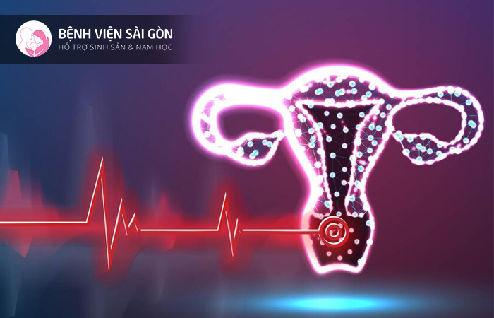 Chụp X-quang tử cung có thể giúp chẩn đoán tình trạng dính buồng tử cung ở phụ nữ