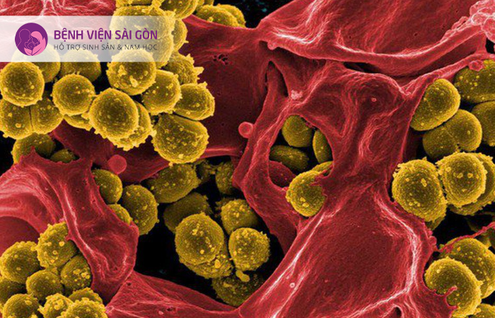 Staphylococcus cầu khuẩn gram dương gây viêm nội mạc tử cung