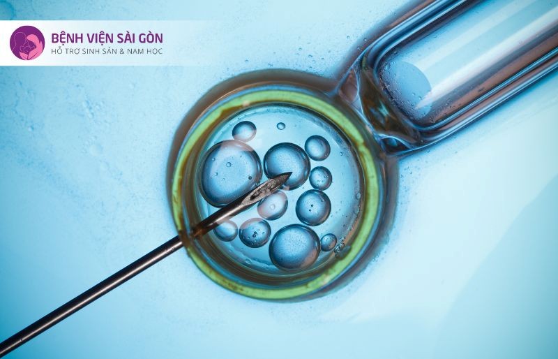 Phương pháp thụ tinh trong ống nghiệm (IVF)