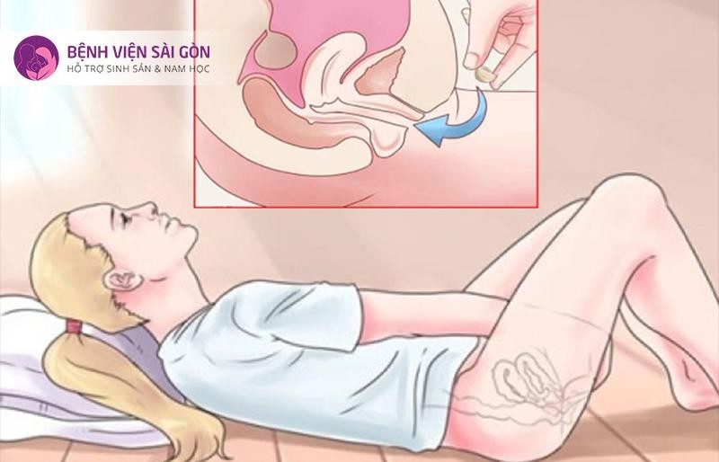Sử dụng Estrogen và Progesterone
