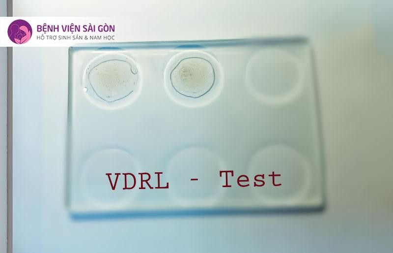 Xét nghiệm VDRL