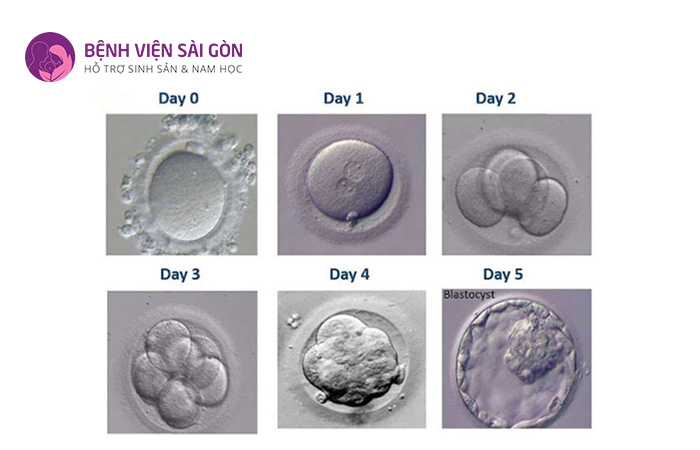 Trong IVF giai đoạn phát triển phôi diễn ra trong phòng thí nghiệm