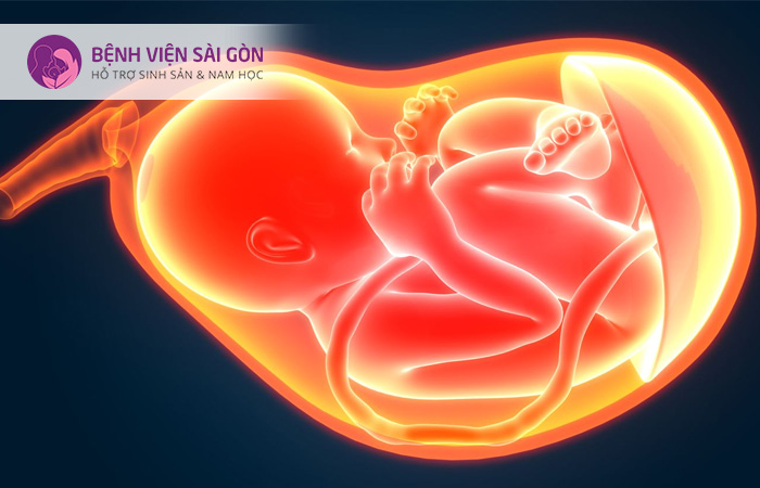 Thuyên tắc ối có thể xảy ra trước, trong và sau sinh