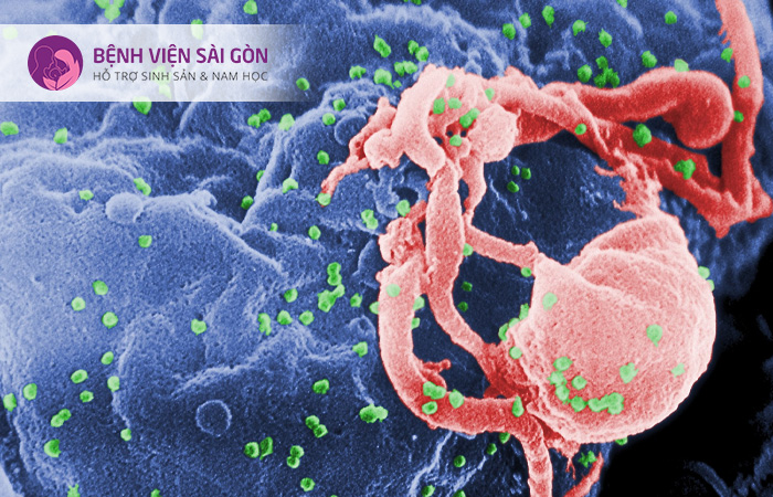 Người mắc HIV/AIDS thường có biểu hiện mệt mỏi, sốt, sụt cân, đau họng, sưng hạch bạch huyết toàn thân