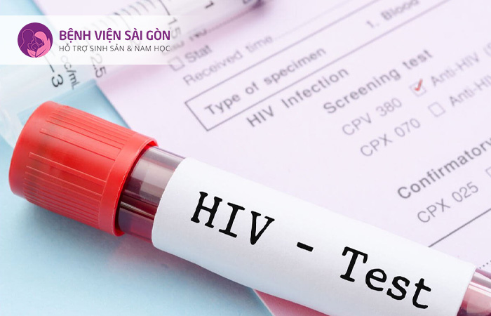 Người bệnh sẽ được thực hiện một số xét nghiệm nếu nghi ngờ mắc HIV/AIDS