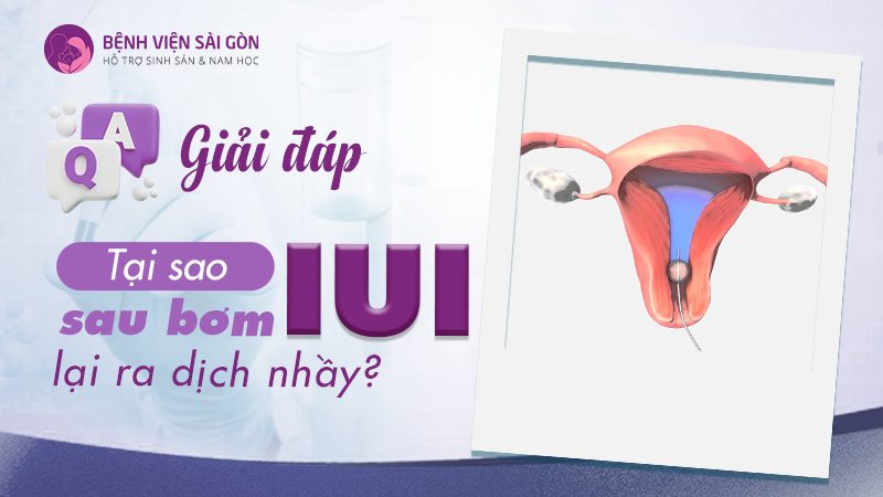 Giải đáp: Tại sao sau bơm IUI lại ra dịch nhầy?