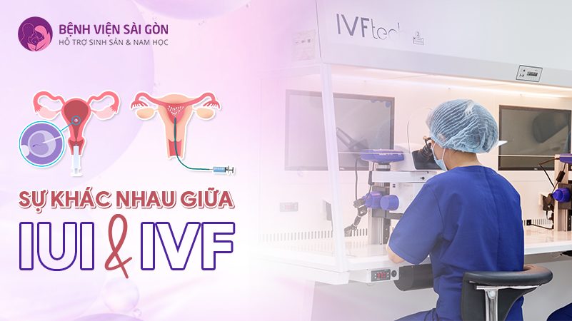 Sự khác nhau giữ IUI & IVF