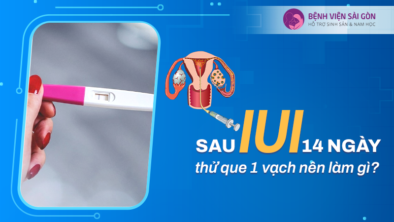 Sau IUI 14 ngày thử que 1 vạch nên làm gì?