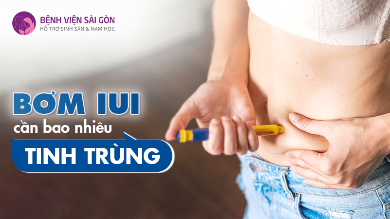 Giải đáp: Bơm IUI cần bao nhiêu tinh trùng?