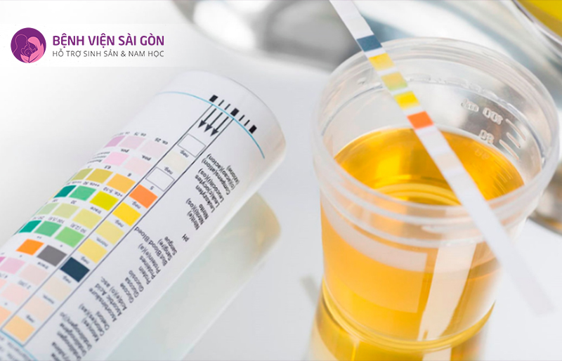 Tổng phân tích nước tiểu