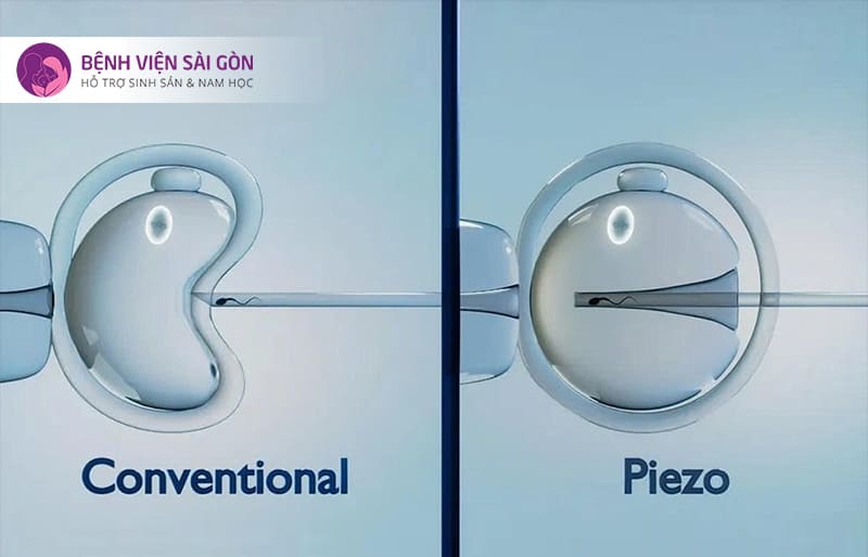 Điểm khác biệt về dịch vụ ICSI