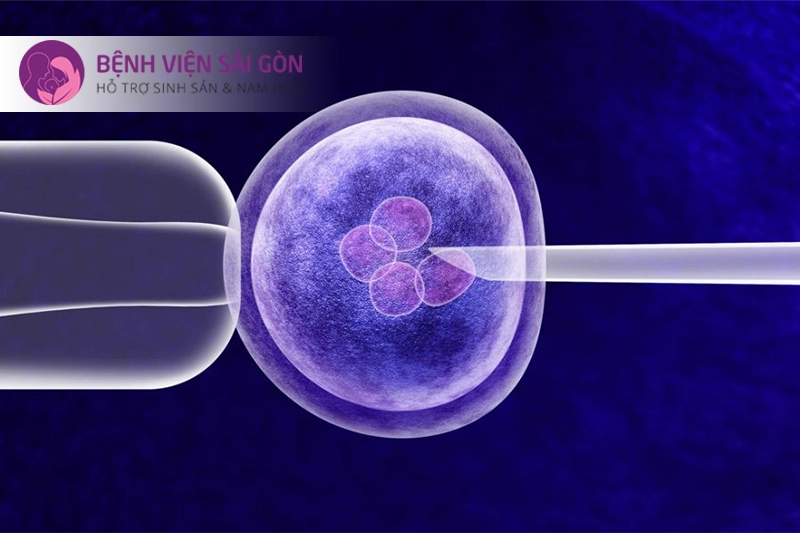 IVF kết hợp ICSI IVF kết hợp ICSI