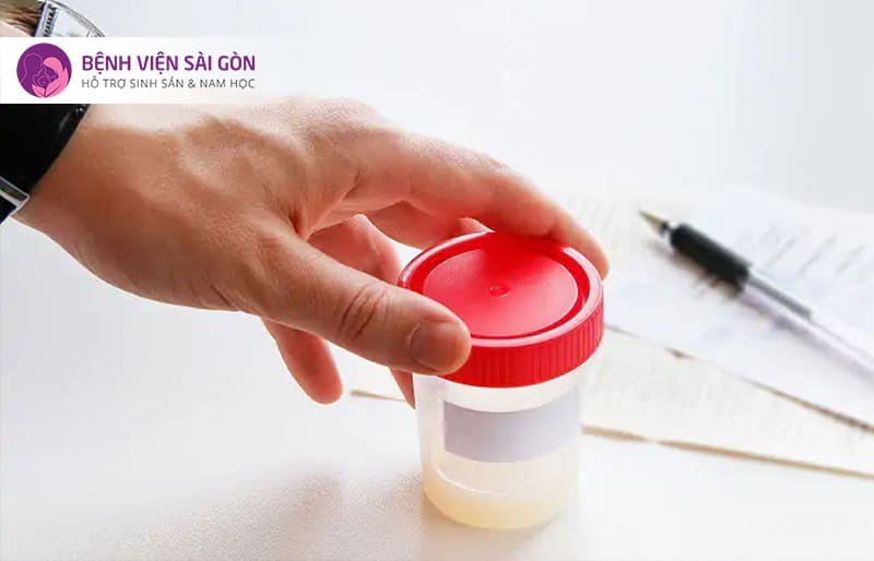 Lấy mẫu tinh trùng
