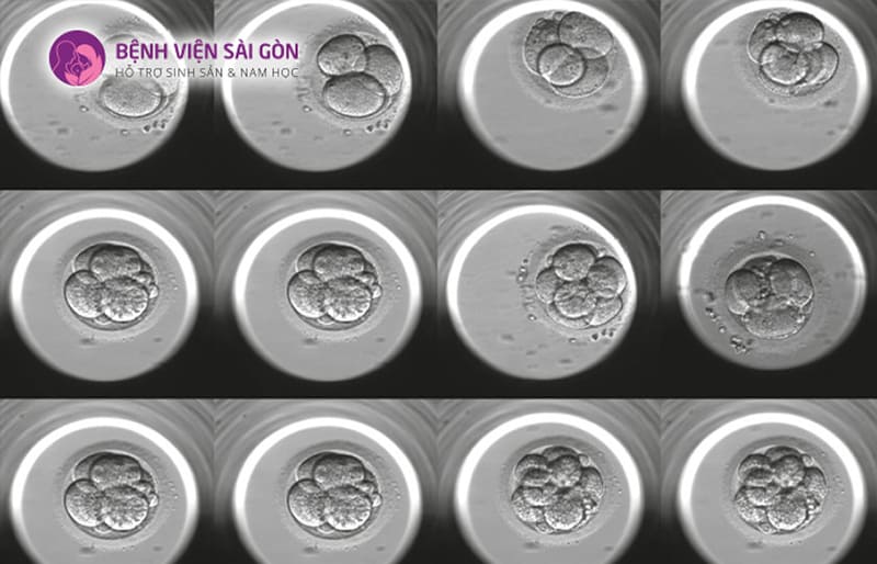 Nuôi cấy phôi Nuôi cấy phôi
