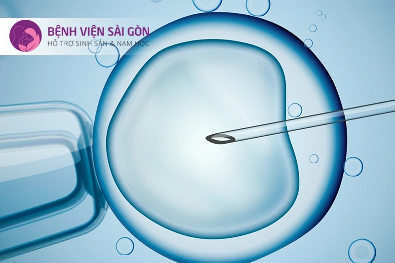 thụ tinh trong ống nghiệm 