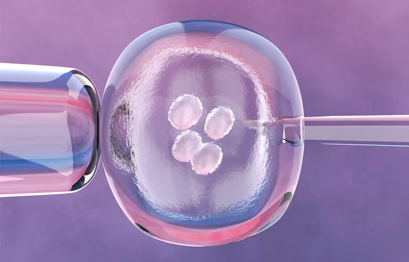IVF phù hợp cho những đối tượng nào?
