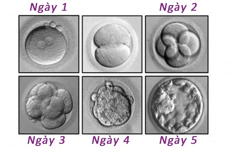 Nuôi phôi đến ngày 5 (phôi nang)